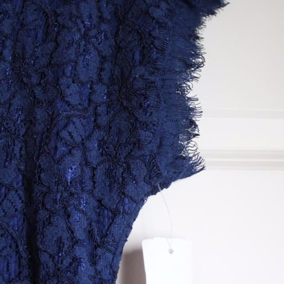 DVF Blue Lace Dress- Wanda - Picture 6 of 7
